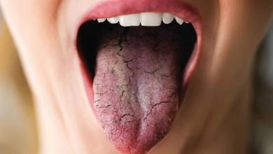 پژوهشگران چینی مکانیسم خشکی دهان را کشف کردند