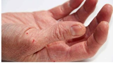 روش های درمان خشکی پوست دست در خانه