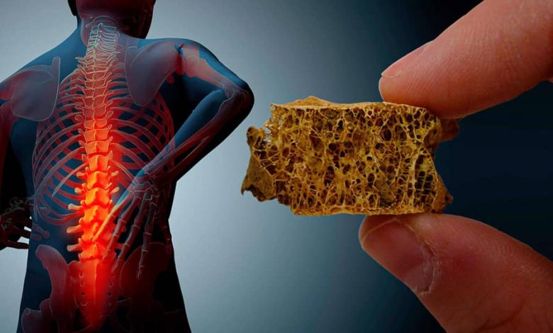 فرار از پوکی استخوان‌ با مصرف این ماده غذایی