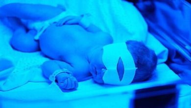 زردی نوزادان، از علامت ساده تا تهدیدی جدی برای مغز