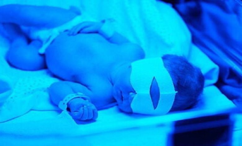 زردی نوزادان، از علامت ساده تا تهدیدی جدی برای مغز