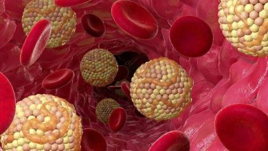 ۵ سبزی معجزه گربرای کاهش کلسترول بعد از ۵۰ سالگی