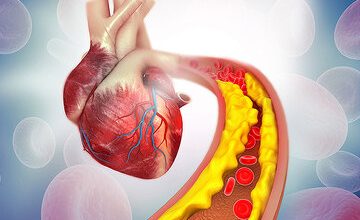 ۵ راه اساسی برای کم کردن کلسترول را بخوانید