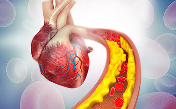 ۵ راه اساسی برای کم کردن کلسترول را بخوانید